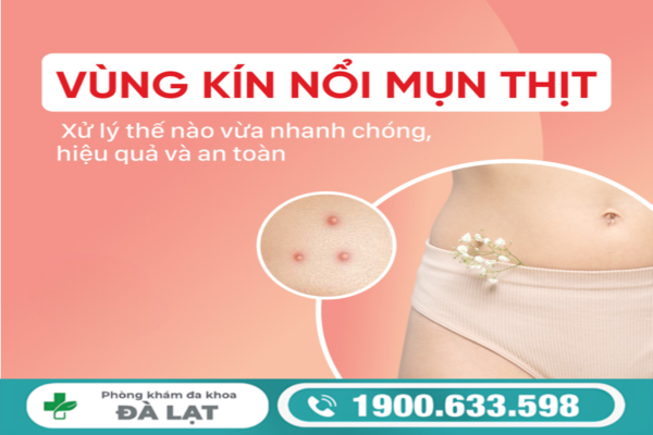 NAM VÀ NỮ BỊ MỌC MỤN THỊT Ở VÙNG KÍN VÀ CÁCH ĐIỀU TRỊ 