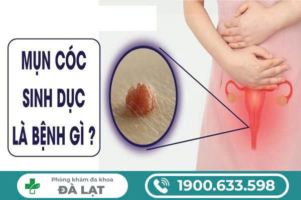 NAM VÀ NỮ NỔI MỤN CÓC VÙNG KÍN VÀ CÁCH ĐIỀU TRỊ 