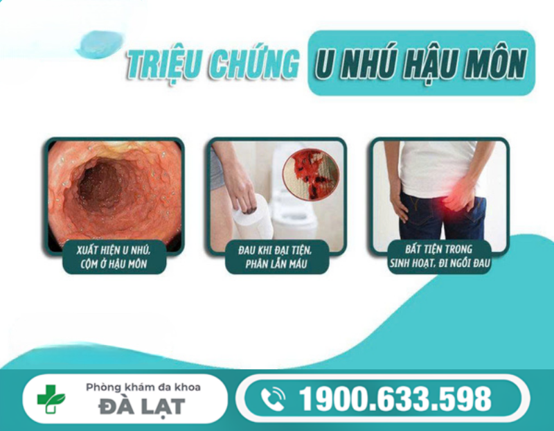 HẬU MÔN MỌC THỊT THỪA VÀ CÁCH ĐIỀU TRỊ 