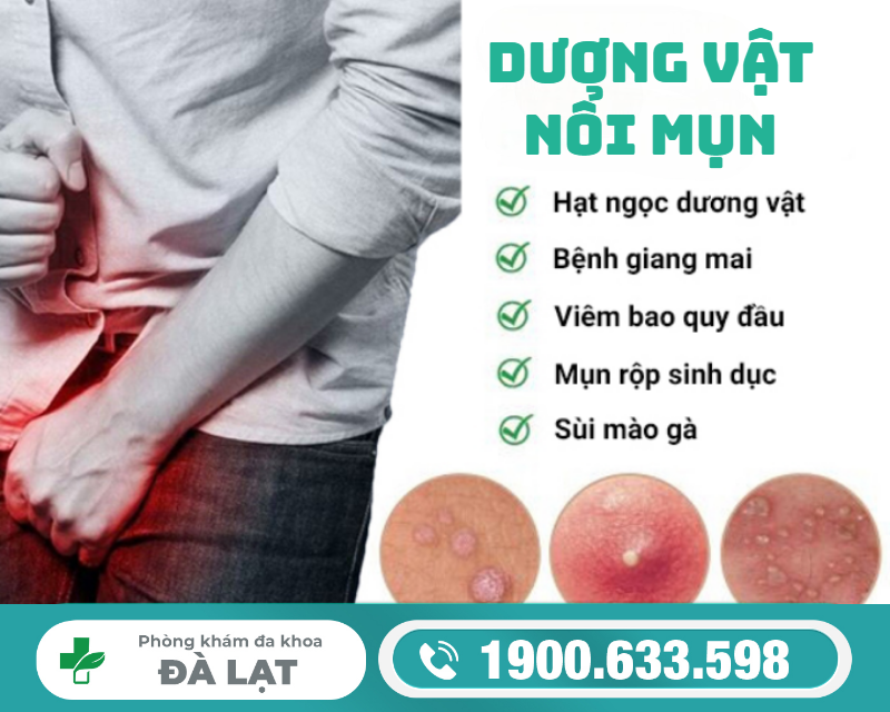 DƯƠNG VẬT NỔI MỤN LÀ BỆNH GÌ? NGUYÊN NHÂN VÀ CÁCH ĐIỀU TRỊ