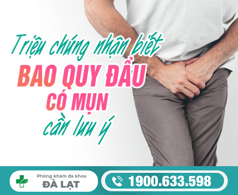 TÌM HIỂU MỌC MỤN Ở BAO QUY ĐẦU