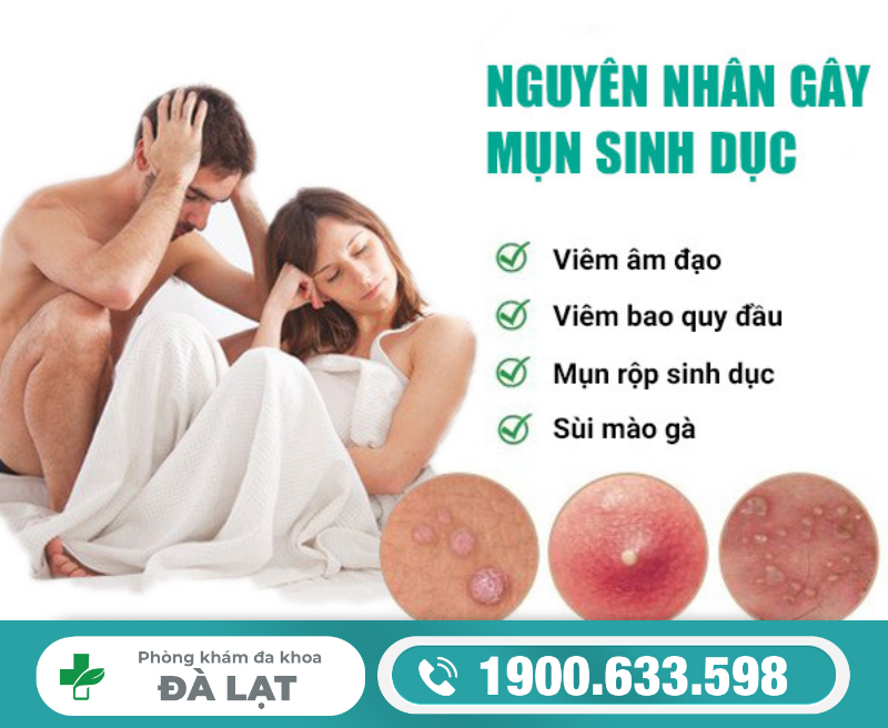 MỤN MỦ Ở BỘ PHẬN SINH DỤC LÀ BỆNH GÌ? NGUYÊN NHÂN & CÁCH CHỮA