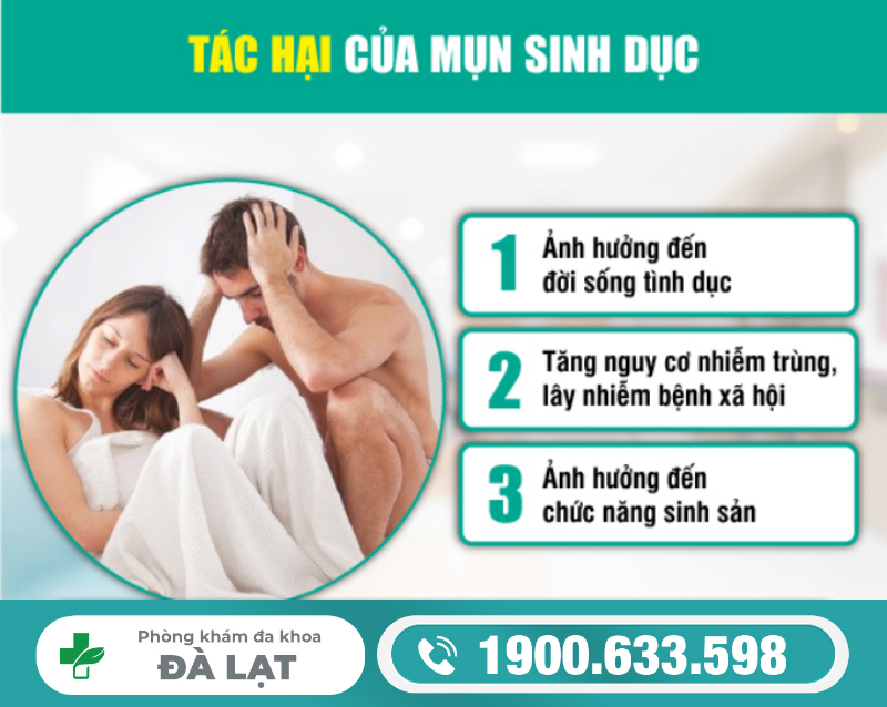 CÁCH ĐIỀU TRỊ MỤN SINH DỤC Ở NAM VÀ NỮ HIỆU QUẢ, AN TOÀN