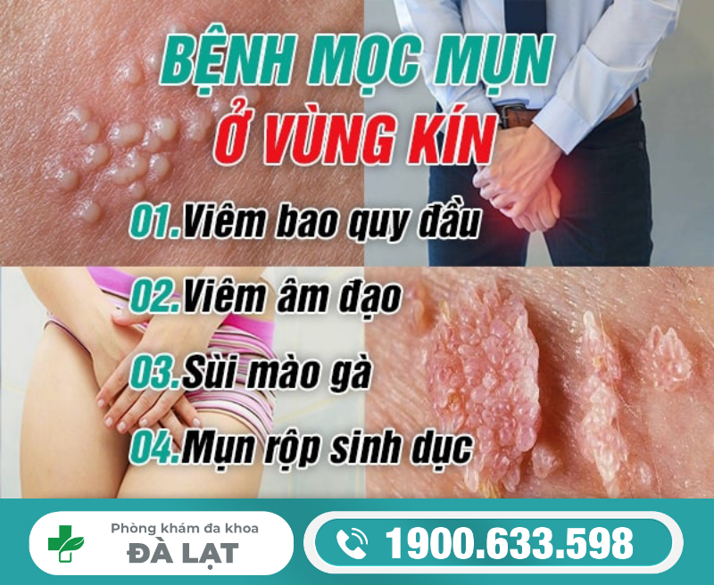 MỌC MỤN Ở VÙNG KÍN LÀ BỆNH GÌ? NGUYÊN NHÂN VÀ CÁCH ĐIỀU TRỊ HIỆU QUẢ