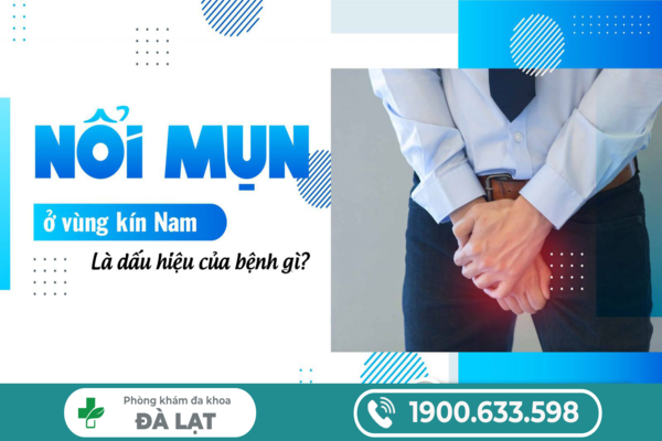 BỆNH MỌC MỤN Ở VÙNG KÍN NAM