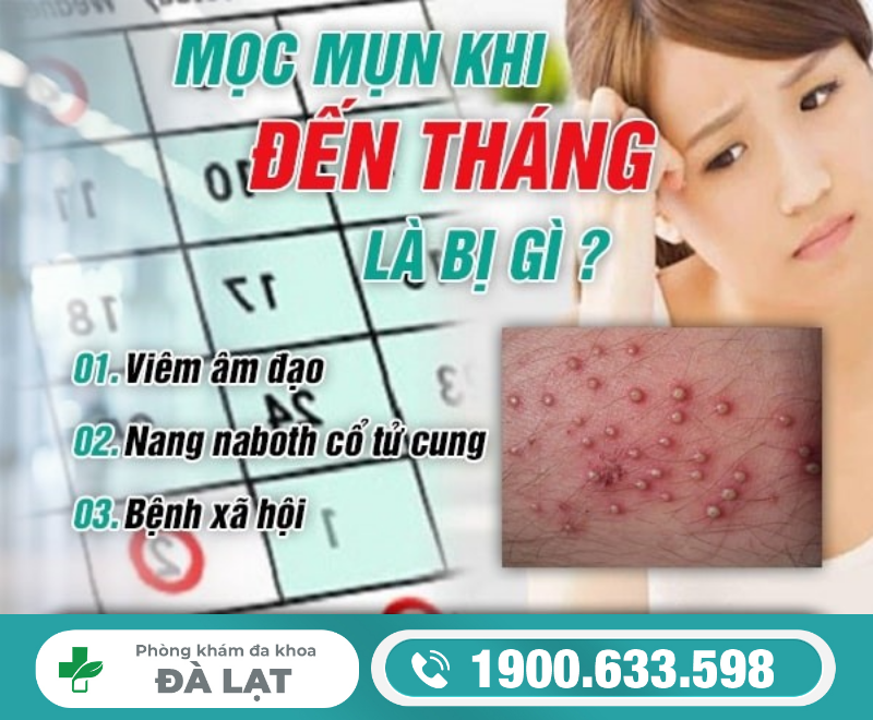 MỌC MỤN Ở VÙNG KÍN KHI ĐẾN THÁNG