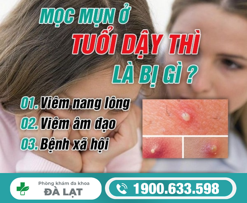 MỌC MỤN Ở VÙNG KÍN TUỔI DẬY THÌ