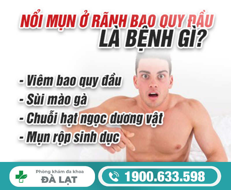 TÌM HIỂU VỀ MỤN Ở RÃNH QUY ĐẦU