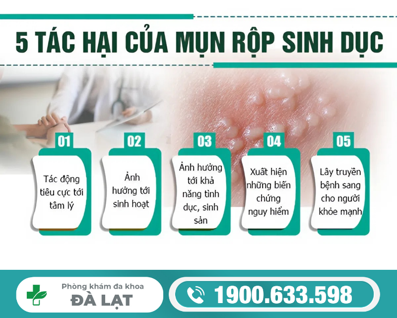 MỤN RỘP SINH DỤC CÓ TÁC HẠI NHƯ THẾ NÀO?
