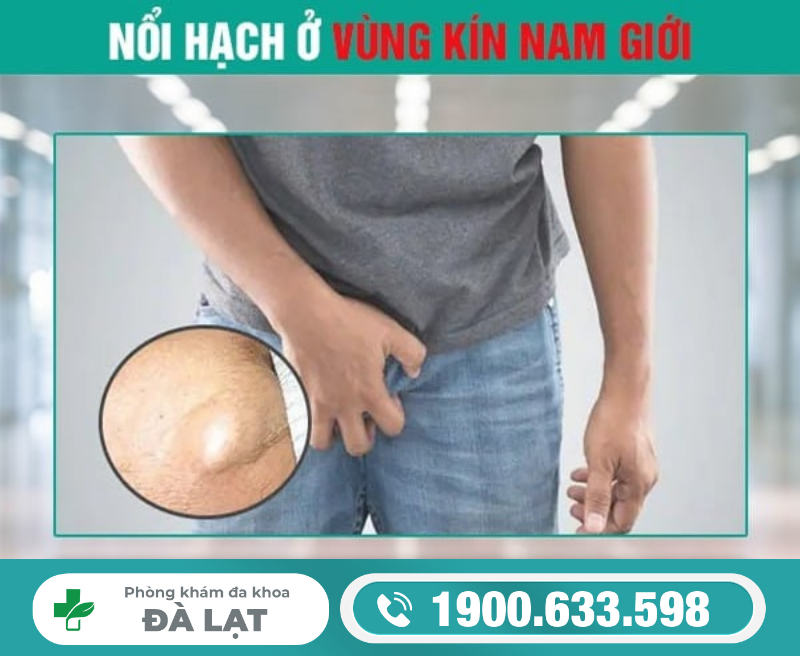 NỔI HẠCH Ở DƯƠNG VẬT