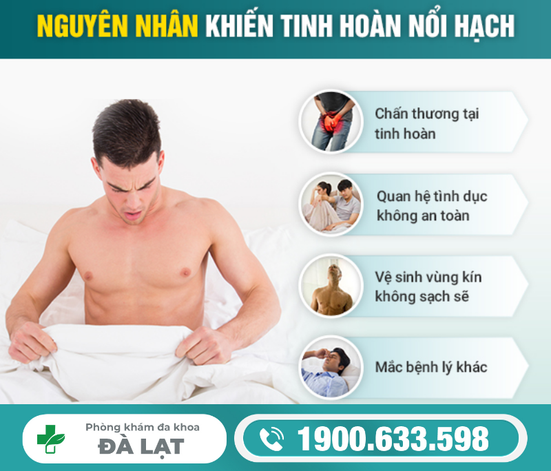 NỔI HẠCH Ở TINH HOÀN NAM GIỚI