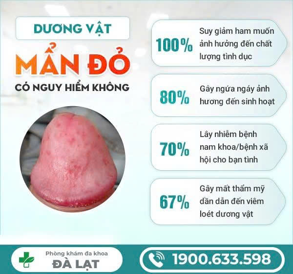 NỔI MẨN Ở BAO QUY ĐẦU - ĐIỀU TRỊ THẾ NÀO?