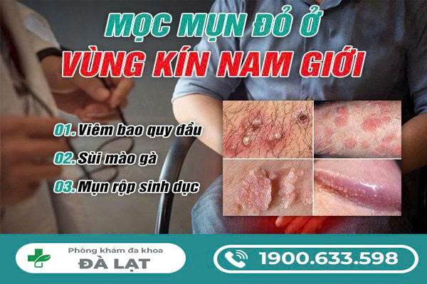 NỔI MẨN ĐỎ Ở ĐẦU KHẤC