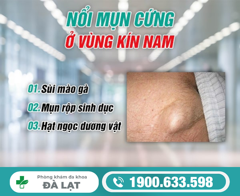 NỔI MỤN CỨNG Ở VÙNG KÍN NAM GIỚI
