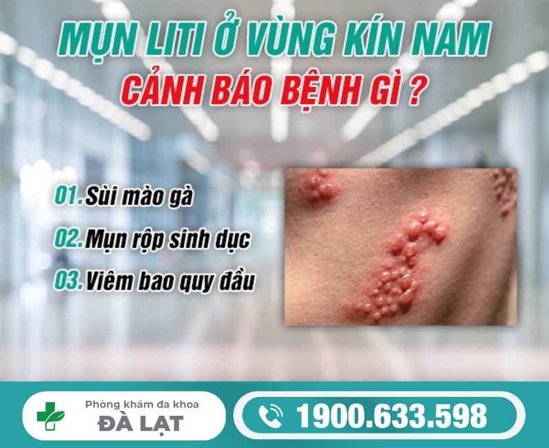 DƯƠNG VẬT NỔI MỤN LI TI