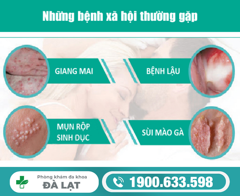 BỆNH XÃ HỘI CÓ CHỮA ĐƯỢC KHÔNG? GIẢI ĐÁP TỪ BÁC SĨ 