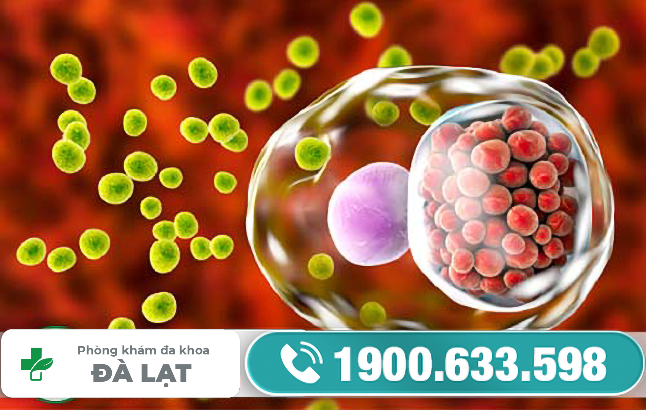 BỆNH CHLAMYDIA CÓ KHOẢNG THỜI GIAN Ủ BỆNH LÀ BAO LÂU ?