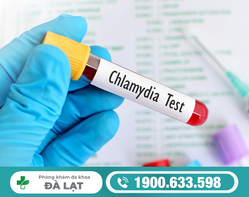  XÉT NHIỆM CHLAMYDIA NHƯ THẾ NÀO ?