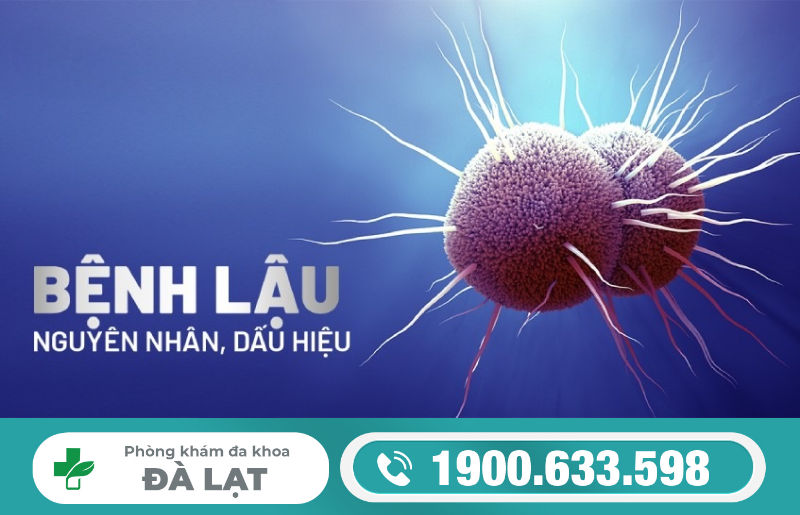 BÁC SĨ TƯ VẤN VỀ BỆNH LẬU 