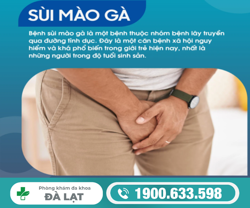 Tìm Hiểu: Bệnh Sùi Mào Gà
