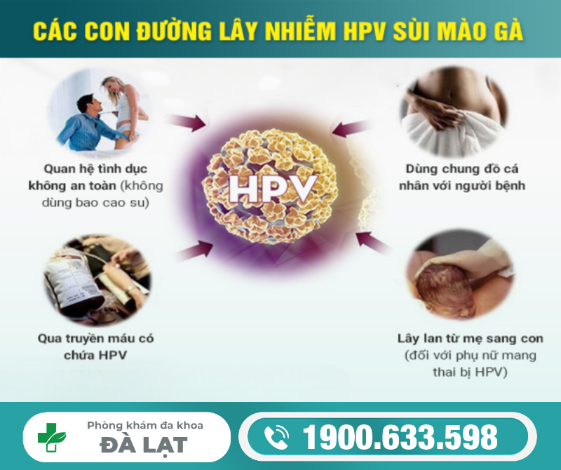 Sùi Mào Gà Lây Truyền Qua Đường Nào 