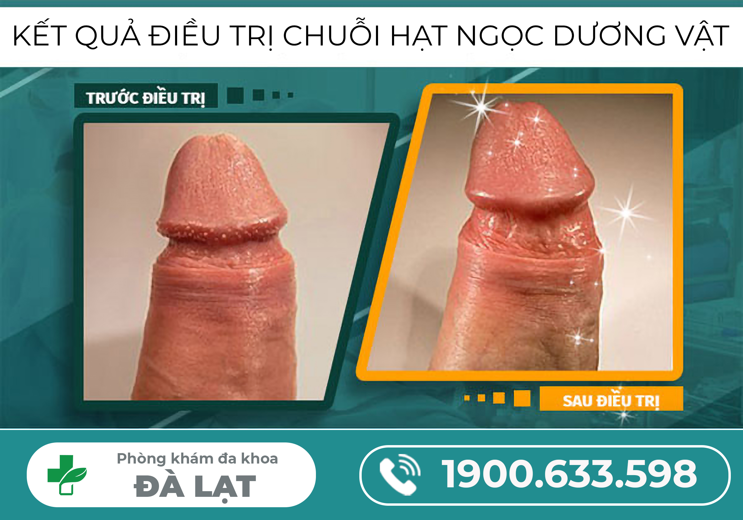 CHUỖI HẠT NGỌC DƯƠNG VẬT LÀ GÌ?
