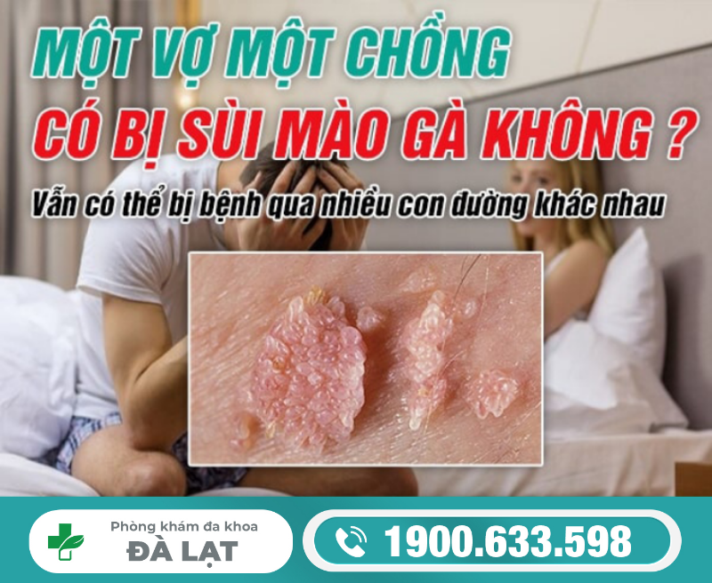 Một Vợ Một Chồng Có Bị Sùi Mào Gà Không? 