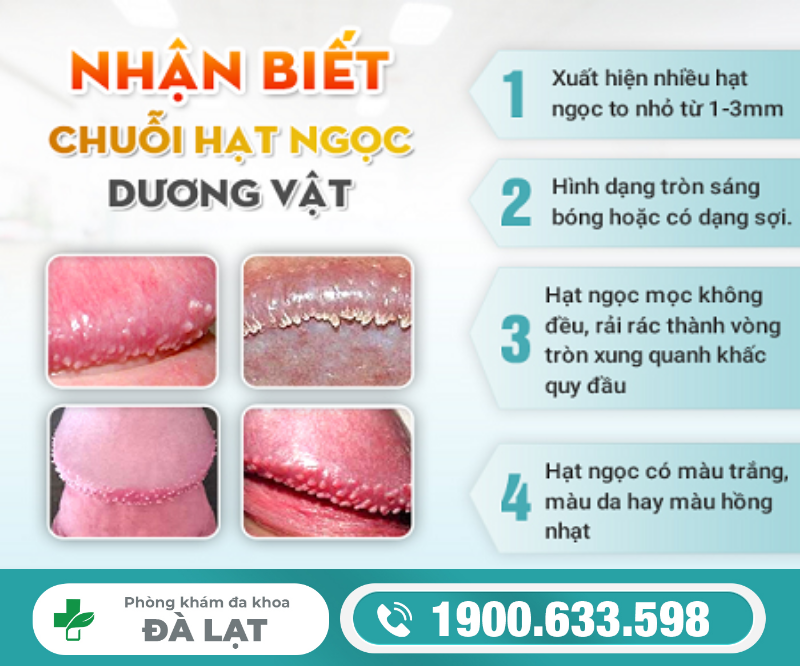 HẠT NGỌC DƯƠNG VẬT CÓ LÂY KHÔNG?