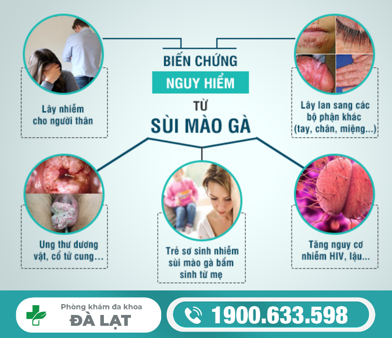 CÁC BIỂU HIỆN BỆNH SÙI MÀO GÀ Ở HẬU MÔN