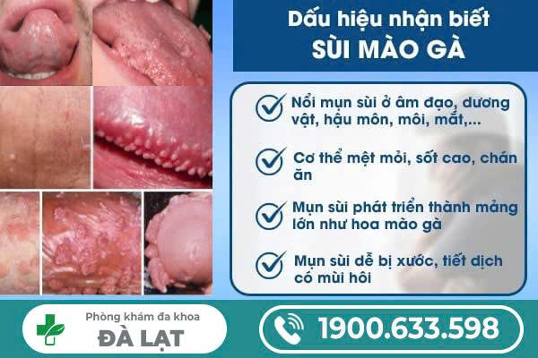 DẤU HIỆU SÙI MÀO GÀ THƯỜNG GẶP Ở VÙNG KÍN
