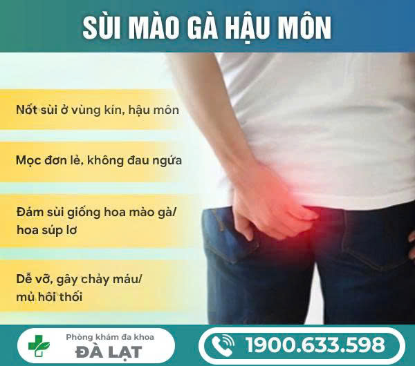 TÌM HIỂU SÙI MÀO GÀ Ở HẬU MÔN NAM VÀ NỮ GIỚI