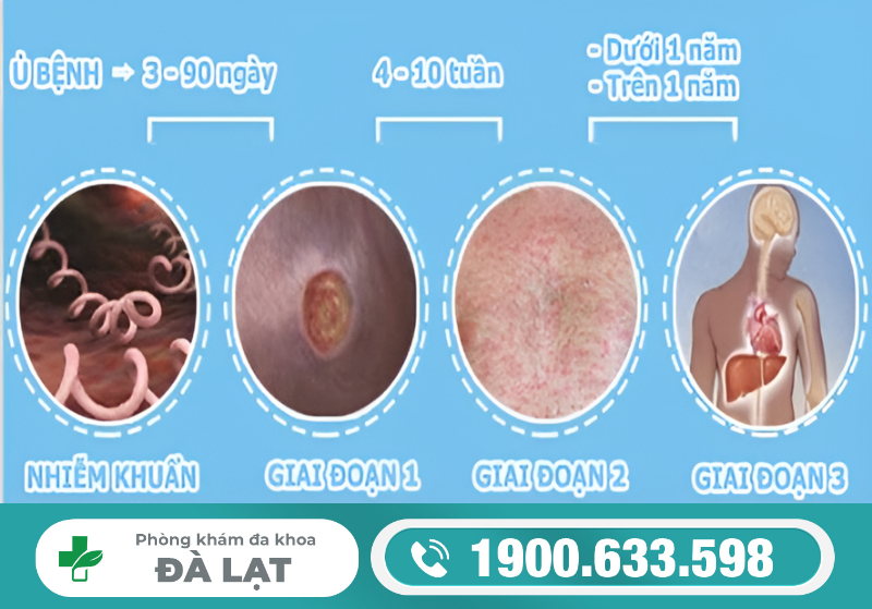 TÌM HIỂU VỀ BỆNH GIANG MAI