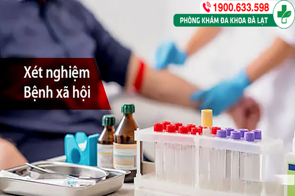 Xét Nghiệm Máu Phát Hiện Bệnh Sùi Mào Gà 