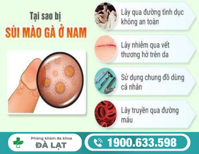 NGUYÊN NHÂN GÂY BÊNH SÙI MÀO GÀ Ở NAM GIỚI THƯỜNG GẶP