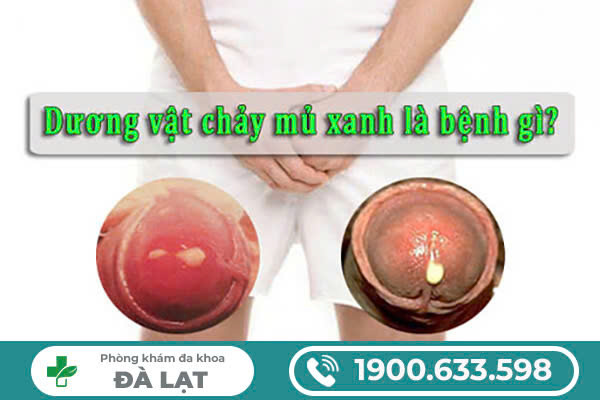 TÌM HIỂU VỀ DƯƠNG VẬT CÓ MỦ XANH 