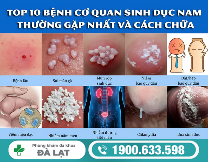 TÌM HIỂU CHI TIẾT VỀ GIỌT MỦ BAN MAI Ở NAM GIỚI